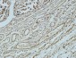 Bcl-2 Monoclonal Antibody(6B5)